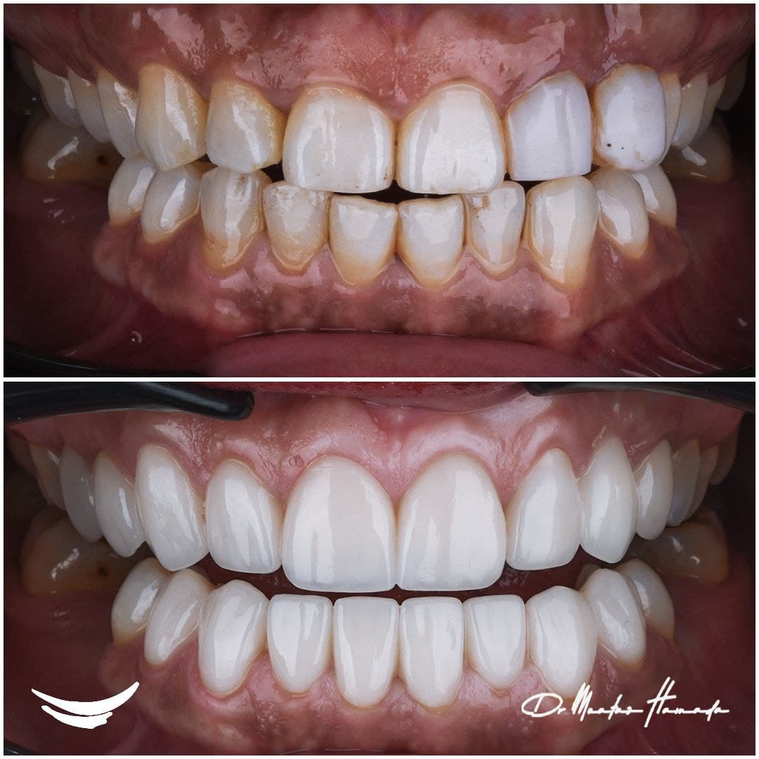 Before and after cosmetic dentistry transformation 3